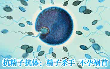 抗精子抗体怎么办 抗精子抗体怎么办？