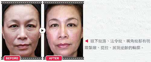 拒绝黄脸婆 拒当黄脸婆－健康篇