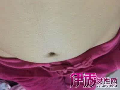 为什么怀孕肚子上长毛 怀孕后肚子为什么会长毛