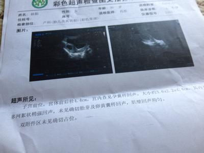 孕囊发育慢的原因 孕囊发育慢的原因 孕囊发育慢有影响吗
