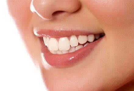 牙齿激光美白价格 激光美白牙齿价格 激光美白牙齿的价格