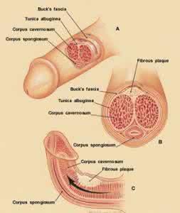 阴茎海绵体充血不足 男性生殖器阴茎海绵体组织在哪里