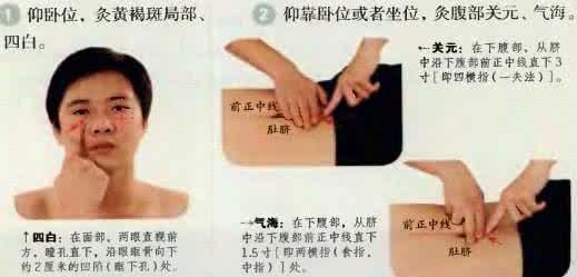 艾灸黄褐斑多久见效 艾灸去黄褐斑 艾灸两个穴位可治疗黄褐斑
