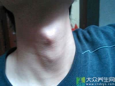 喉结大的男人 喉结只是男人专属的吗