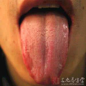 舌苔颜色各代表什么 舌苔发白是怎么回事 舌苔颜色代表的状况