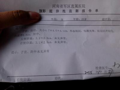 医院怎么测卵泡 医院测卵泡怎么测的?