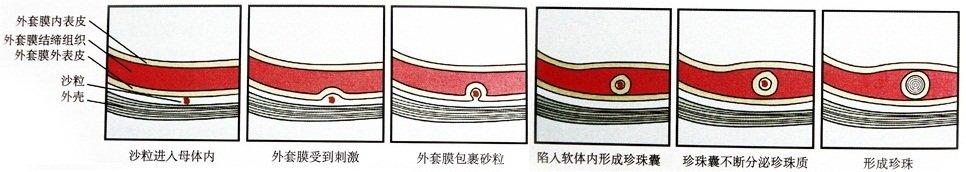 龟头珍珠疹的原因 珍珠形成的过程 珍珠形成过程及其原因