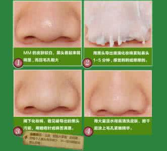 敏感肌肤怎么去黑头 敏感肌肤去黑头 黑头导出液怎么用 击退黑头让肌肤零瑕疵