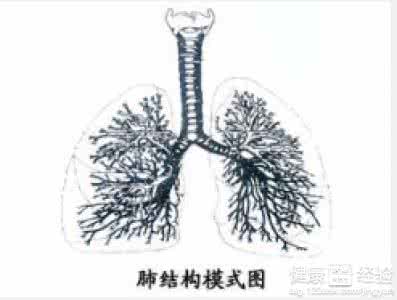 支气管扩张能根治吗 支气管扩张能根治吗 支气管扩张能根治吗 试试这一招