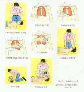 急救常识心肺复苏 急救常识 心肺复苏的急救方法