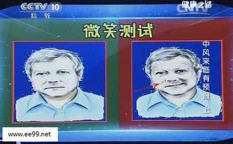 健康之路 脑中风 健康之路视频20141111 姜卫剑讲脑中风前兆,什么是脑中风