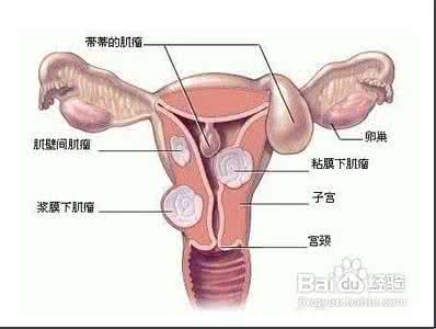 乳房自我检查方法 子宫肌瘤怎么检查 子宫肌瘤的自我检查方法