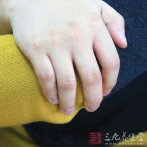 治疗四肢麻木的特效药 四肢麻木 四肢麻木要怎样预防