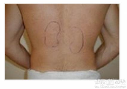 女性肾阳虚症状有哪些 女性肾阳虚的表现症状是什么