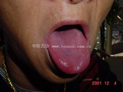中医舌诊与五脏关系 《舌诊与健康生活》连载01