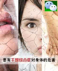 治疗干燥综合症偏方 治疗干燥综合症偏方 干燥综合症的症状