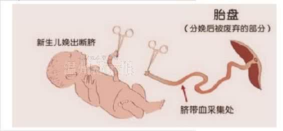 生命银行脐带血储存 生命银行提醒：救命的脐带血千万要保住