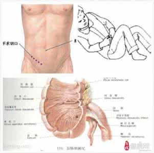 阑尾炎手术后注意事项 阑尾炎手术后注意事项 什么是阑尾炎？阑尾炎手术后的注意事项