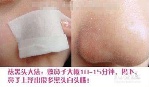 小苏打去黑头 小苏打去黑头 我们曾经的错误选择