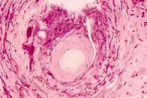 阴囊炎的有效治疗方法 老年阴炎用什么药最好 老年性阴道炎的治疗方法