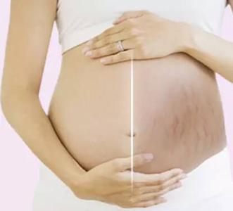 孕妇专用橄榄油 孕妇可以用橄榄油吗
