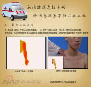 外伤止血药有哪些 外伤止血急救手册 外伤止血的急救措施