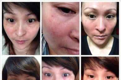 乐敦cc美白淡斑精华 淡斑 均匀肤色 美白淡斑均匀肤色怎么做呢?