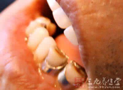 丰胸的偏方和小妙招 牙痛偏方 生活小妙招快速治牙痛