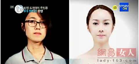 温州特色整容整形机构 整容真人秀免费整形失败 整形应找合格机构