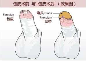 ct胸透对备孕的影响 备孕 包皮过长有什么影响_备孕