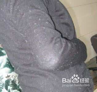 衣服沾毛怎么办 衣服上沾了好多毛怎么去掉