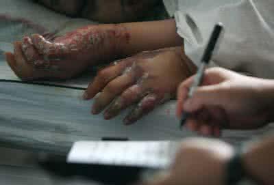 最科学的艾滋病窗口期 被艾滋侵袭的城市 如何科学看待艾滋病