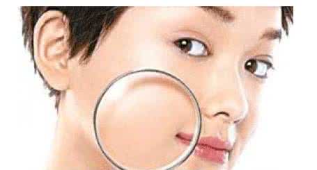 嘴巴周围长痘的原因 嘴巴周围长痘的原因 长痘是如何引起的