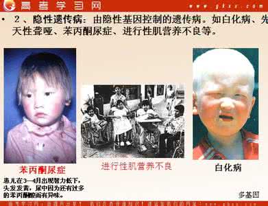 遗传病的最基本特征是 遗传病最基本的特征是 遗传病基本疗法