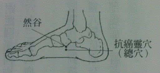 针灸治疗癌症 人体足部抗癌穴位——针灸治疗癌症的中医偏方