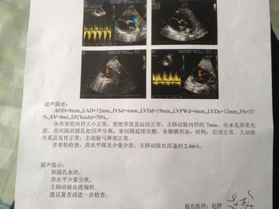 新生儿心脏彩超怎么做 是否新生儿可以做心脏彩超吗