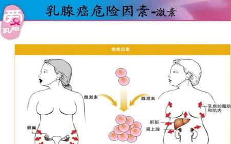 乳腺癌发病率 乳腺癌等乳腺疾病的发病率逐步增高