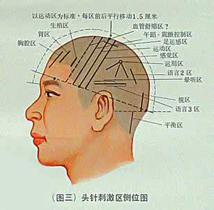 命名性失语 命名性失语 什么是命名性失语