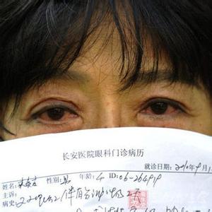 春季红眼病 春季“红眼病”来袭 如何避免