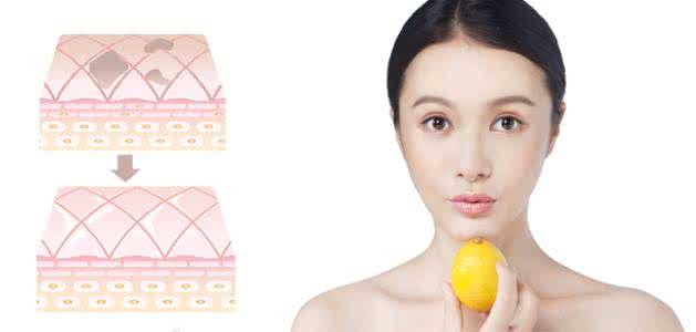 果酸祛斑有什么副作用 果酸美白 果酸美白需要注意什么