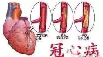心梗支架 它是天然血管支架，通血管、防心梗，常吃不用再担心血栓~