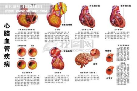 心血管支架的使用寿命 血管的寿命就是你的寿命