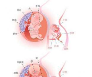 怀孕四个月打胎 怀孕四个月如何打胎 怀孕四个月打胎伤害大