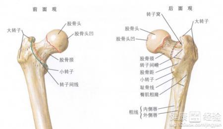 股骨头坏死的治疗方法 股骨头坏死的治疗方法 股骨头坏死怎么治