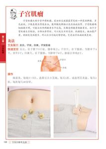 艾灸治疗常见病 常见病的艾灸治疗