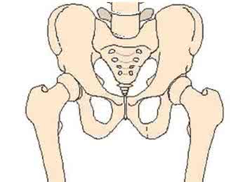 股骨头坏死的治疗方法 股骨头坏死的治疗 三种方法治股骨头坏死