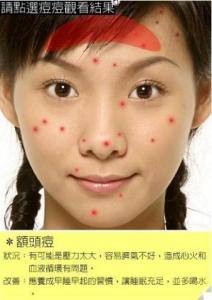 下巴长痘痘消除小妙招 下巴长痘痘六大原因