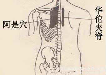 名医珍藏秘方大全 名医秘方：面肌痉挛圣方