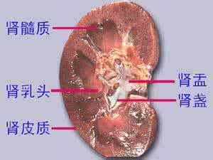 脑梗 高血压 小脑萎缩 图文：血压冲上天，竟是肾萎缩