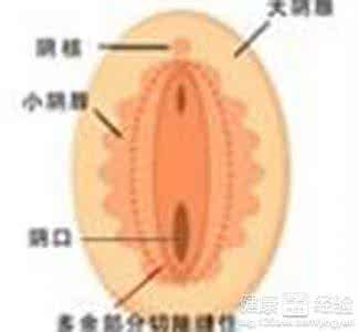 龟头溃烂是什么病 阴部红肿溃烂注意什么呢？